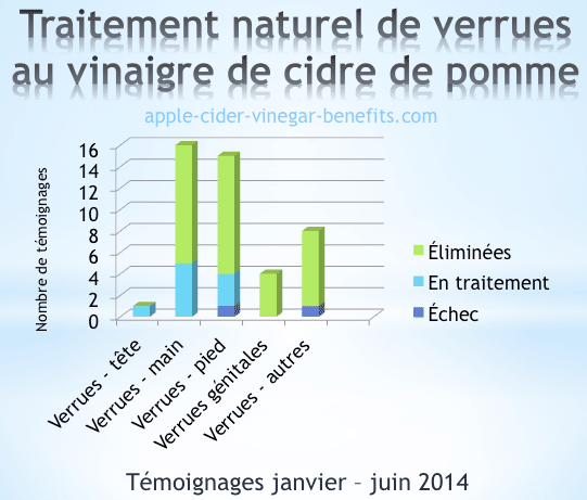 Linstitut selon la varicosité des veines